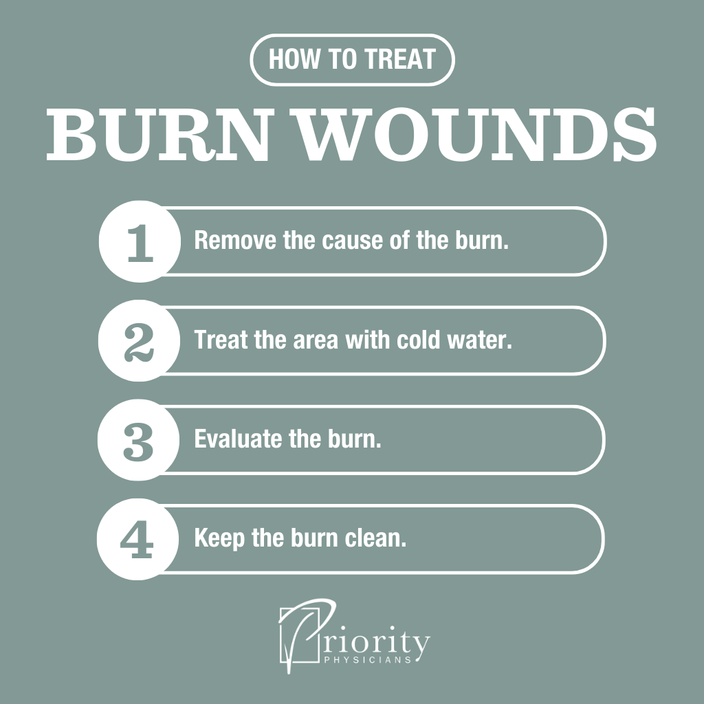 Infographic: A Doctor’s Guide for Burn Wound Care (Do THIS Right Away) 