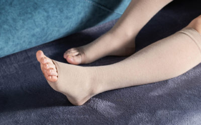 How to Improve Circulation in Legs and Feet: A Physician’s Tips