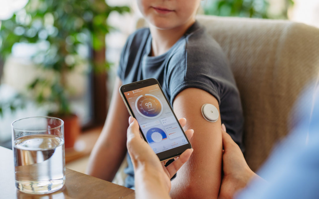 Continuous Glucose Monitoring: How Does CGM Work? Should You Try It?