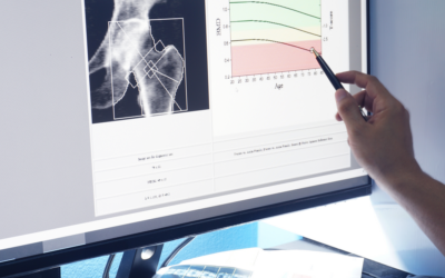 Encourage a Long Lifespan by Increasing Bone Density