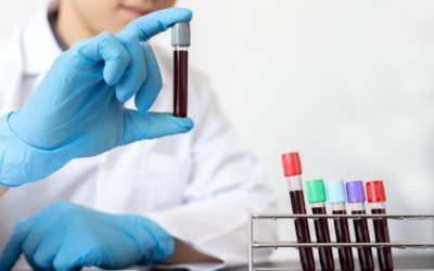 Beyond Traditional Screenings: Galleri Multi-Cancer Early Detection Test