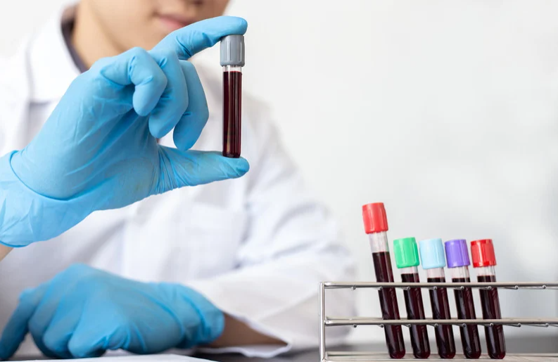 Beyond Traditional Screenings: Galleri Multi-Cancer Early Detection Test